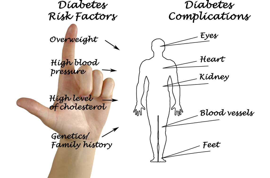 diabetes risk factors listed and beside it a body outline with parts of body where diabetes complications happen listed